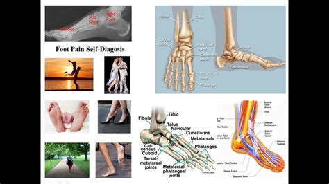 durere sub genunchi pe partea exterioară a piciorului artrita toracică